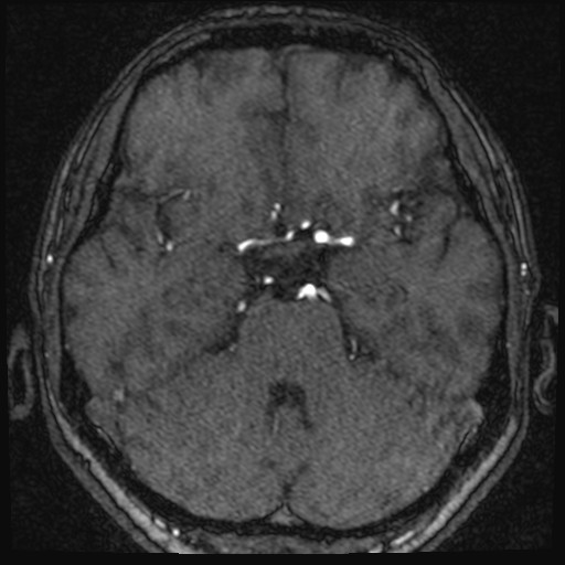 Click on the Serie image to view the images of VILLANUEVA, WILLIAM A.